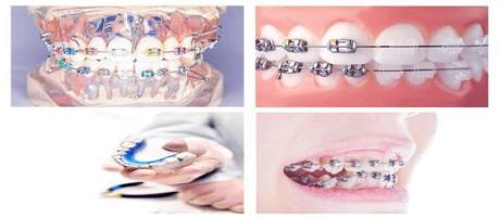 Best Dental Clinic In Dammam