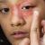 Best Eczema treatment in Dubai - Dr Batra’s Homeopathy