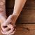 Effective Vitiligo Treatment, Hyperpigmentation Treatment In Dubai | Dr Batra’s Homeopathy